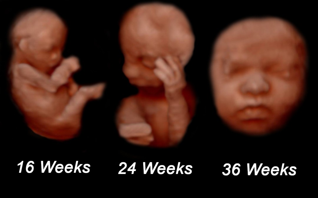 18 week 4d ultrasound pictures